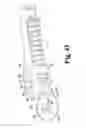 Fig. 41 - Surgical device
