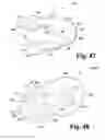 Fig. 45 - Surgical device