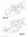 Fig. 49 - Surgical device
