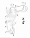 Fig. 52 - Surgical device