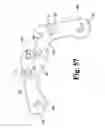 Fig. 53 - Surgical device