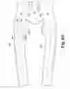Fig. 58 - Surgical device