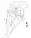 Fig. 70 - Surgical device
