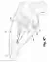 Fig. 71 - Surgical device