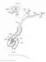 Fig. 01 - Enhanced efficacy lung volume reduction devices, methods, and systems