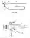 Fig. 04 - Enhanced efficacy lung volume reduction devices, methods, and systems