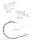 Fig. 18 - Enhanced efficacy lung volume reduction devices, methods, and systems