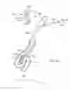 Fig. 40 - Enhanced efficacy lung volume reduction devices, methods, and systems