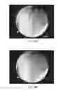 Fig. 48 - Enhanced efficacy lung volume reduction devices, methods, and systems
