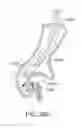 Fig. 51 - Enhanced efficacy lung volume reduction devices, methods, and systems