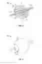 Fig. 04 - Embolization device and a method of using the same