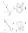 Fig. 10 - Embolization device and a method of using the same
