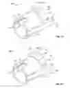 Fig. 11 - Embolization device and a method of using the same