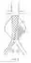 Fig. 08 - Devices and methods for treatment of vascular aneurysms