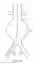 Fig. 23 - Devices and methods for treatment of vascular aneurysms