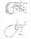 Fig. 03 - Releasably locking tie