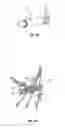 Fig. 05 - METHODS AND APPARATUS FOR TREATING PULMONARY EMBOLISM
