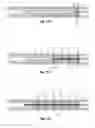 Fig. 17 - METHODS AND APPARATUS FOR TREATING PULMONARY EMBOLISM
