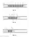 Fig. 18 - METHODS AND APPARATUS FOR TREATING PULMONARY EMBOLISM