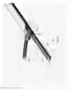 Fig. 04 - Medical ultrasonic cauterization and cutting device and method