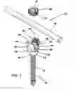 Fig. 02 - Bone fixation system