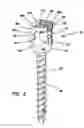 Fig. 03 - Bone fixation system