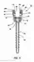 Fig. 06 - Bone fixation system