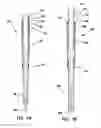 Fig. 12 - Bone fixation system