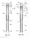 Fig. 13 - Bone fixation system
