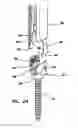 Fig. 15 - Bone fixation system