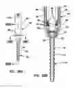 Fig. 19 - Bone fixation system