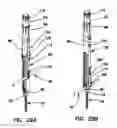 Fig. 20 - Bone fixation system