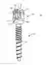 Fig. 01 - SPINAL IMPLANT SYSTEM AND METHODS OF USE