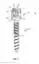 Fig. 02 - SPINAL IMPLANT SYSTEM AND METHODS OF USE