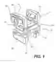 Fig. 02 - Spinous process fixation system and methods thereof
