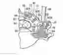 Fig. 01 - Laminoplasty plates and methods of expanding the spinal canal