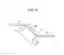 Fig. 06 - Laminoplasty plates and methods of expanding the spinal canal