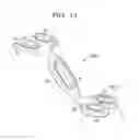 Fig. 08 - Laminoplasty plates and methods of expanding the spinal canal