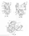 Fig. 07 - Implantation tools for interspinous process spacing device
