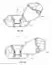 Fig. 09 - Implantation tools for interspinous process spacing device