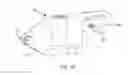 Fig. 14 - Implantation tools for interspinous process spacing device