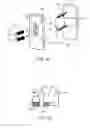 Fig. 16 - Implantation tools for interspinous process spacing device