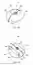 Fig. 22 - Implantation tools for interspinous process spacing device