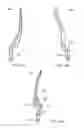 Fig. 29 - Implantation tools for interspinous process spacing device