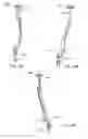 Fig. 30 - Implantation tools for interspinous process spacing device