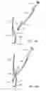 Fig. 31 - Implantation tools for interspinous process spacing device