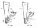 Fig. 37 - Implantation tools for interspinous process spacing device