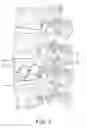 Fig. 06 - Multichannel cannula for kyphoplasty and method of use