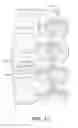 Fig. 13 - Multichannel cannula for kyphoplasty and method of use