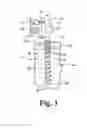 Fig. 03 - MULTI-THREAD BONE SCREW AND METHOD